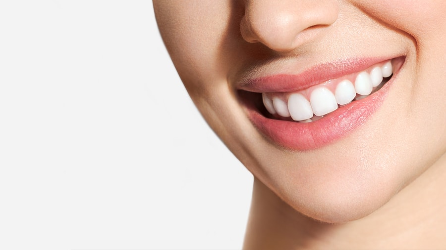 5 Benefits of Professional Teeth Whitening