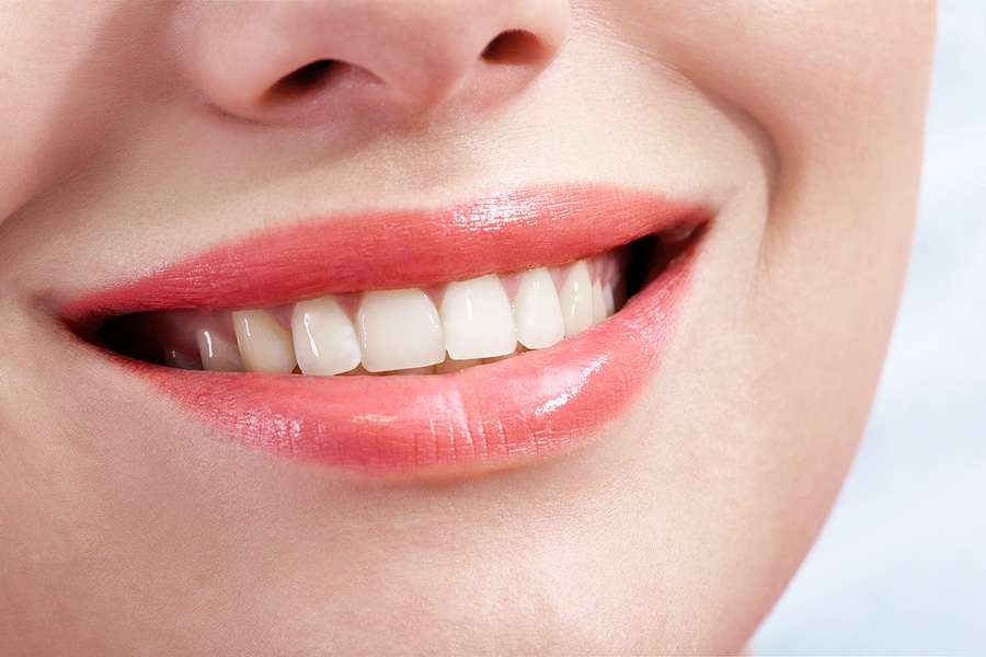 6 Benefits of Professional Teeth Whitening