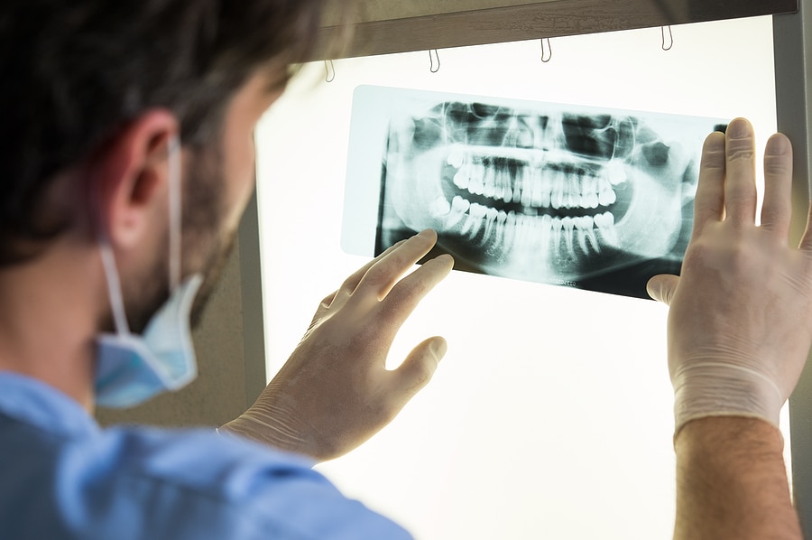 Can Dental Implants Help Prevent Bone Loss?